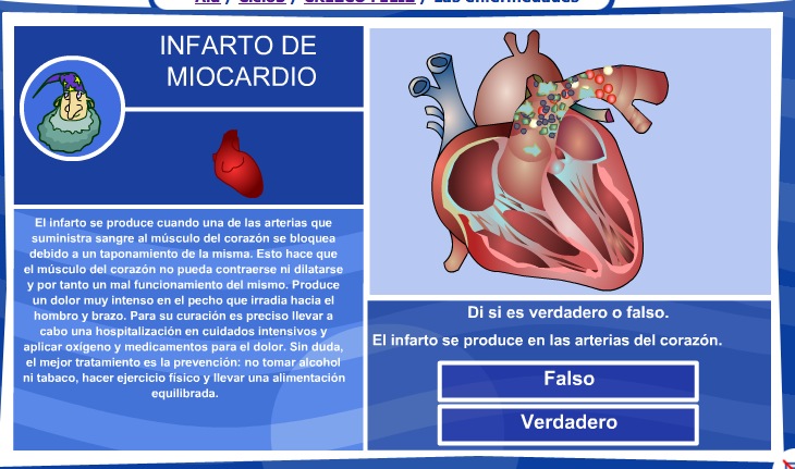 El infarto de miocardio | Recurso educativo 36003