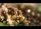 Fern Spores under a microscope | Recurso educativo 743798